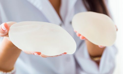 Blog-2